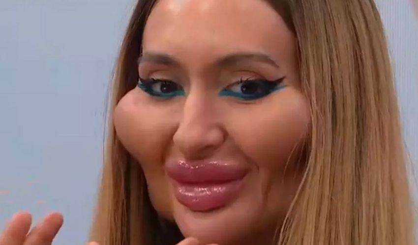 Elmacık kemikleriyle gündem olan Anastasia Pokreshchuk’un estetiksiz hali ortaya çıktı - 1. Resim