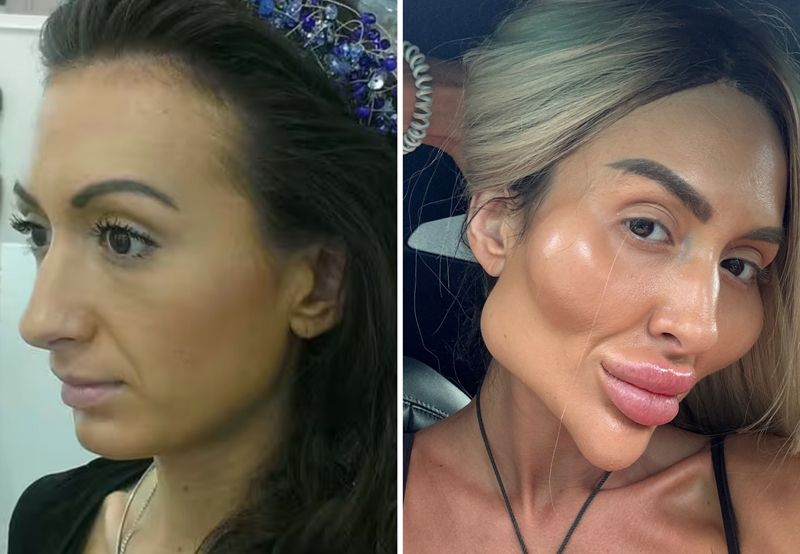 Elmacık kemikleriyle gündem olan Anastasia Pokreshchuk’un estetiksiz hali ortaya çıktı - 2. Resim