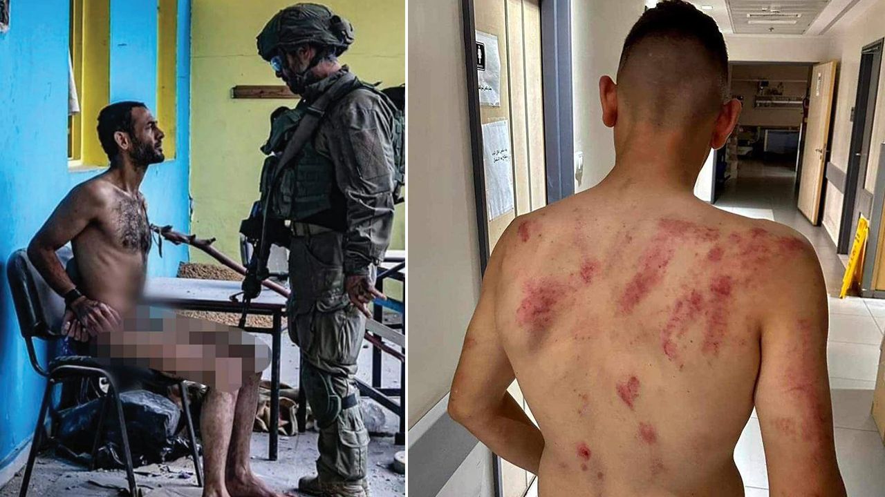 Dışarıda ölüm, içeride işkence! Ya ölüyor ya sakat kalıyor ya da akıllarını kaybediyorlar - 1. Resim