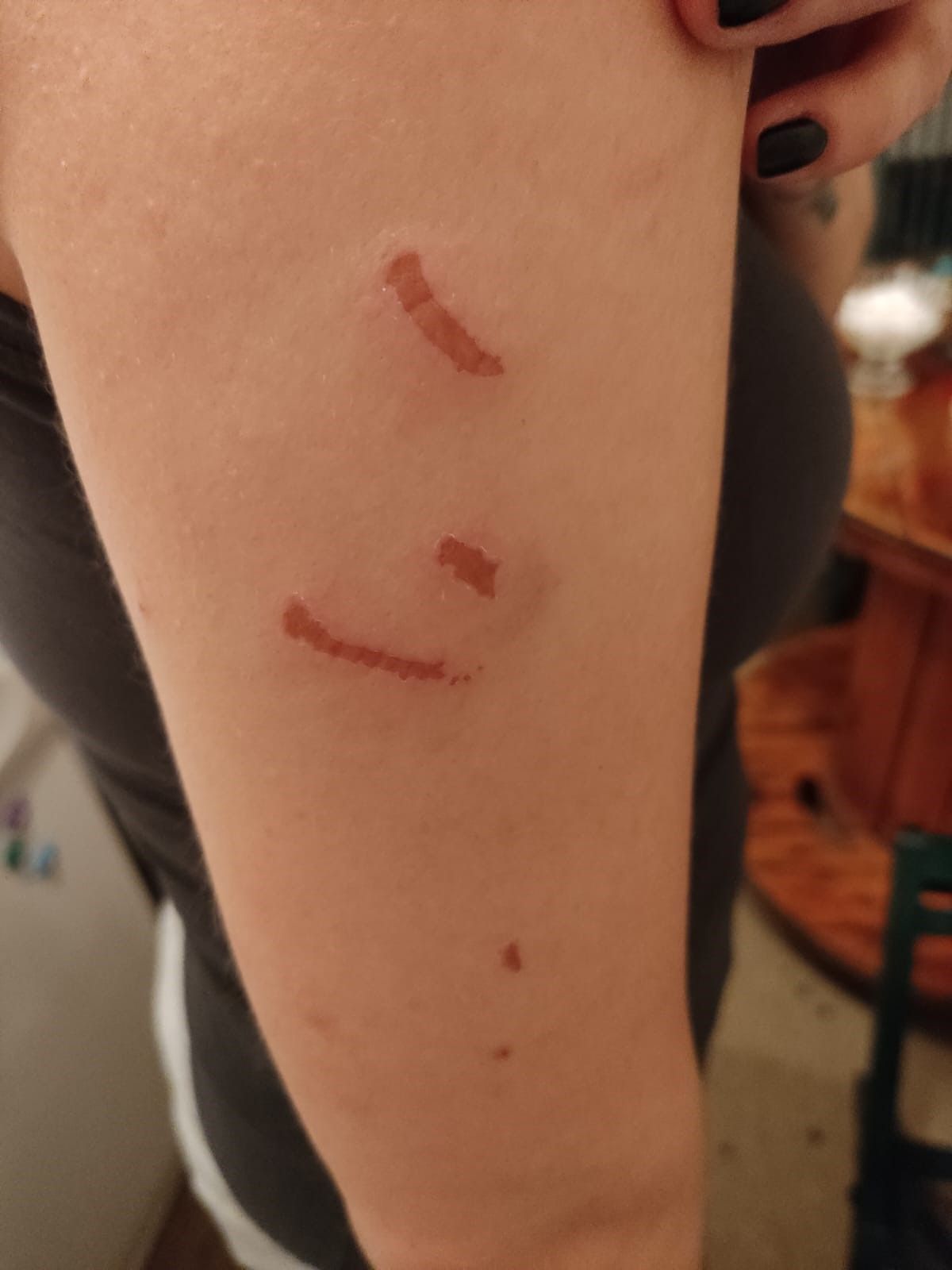 Kadın dart antrenörü turnuvada darp edildi - 3. Resim