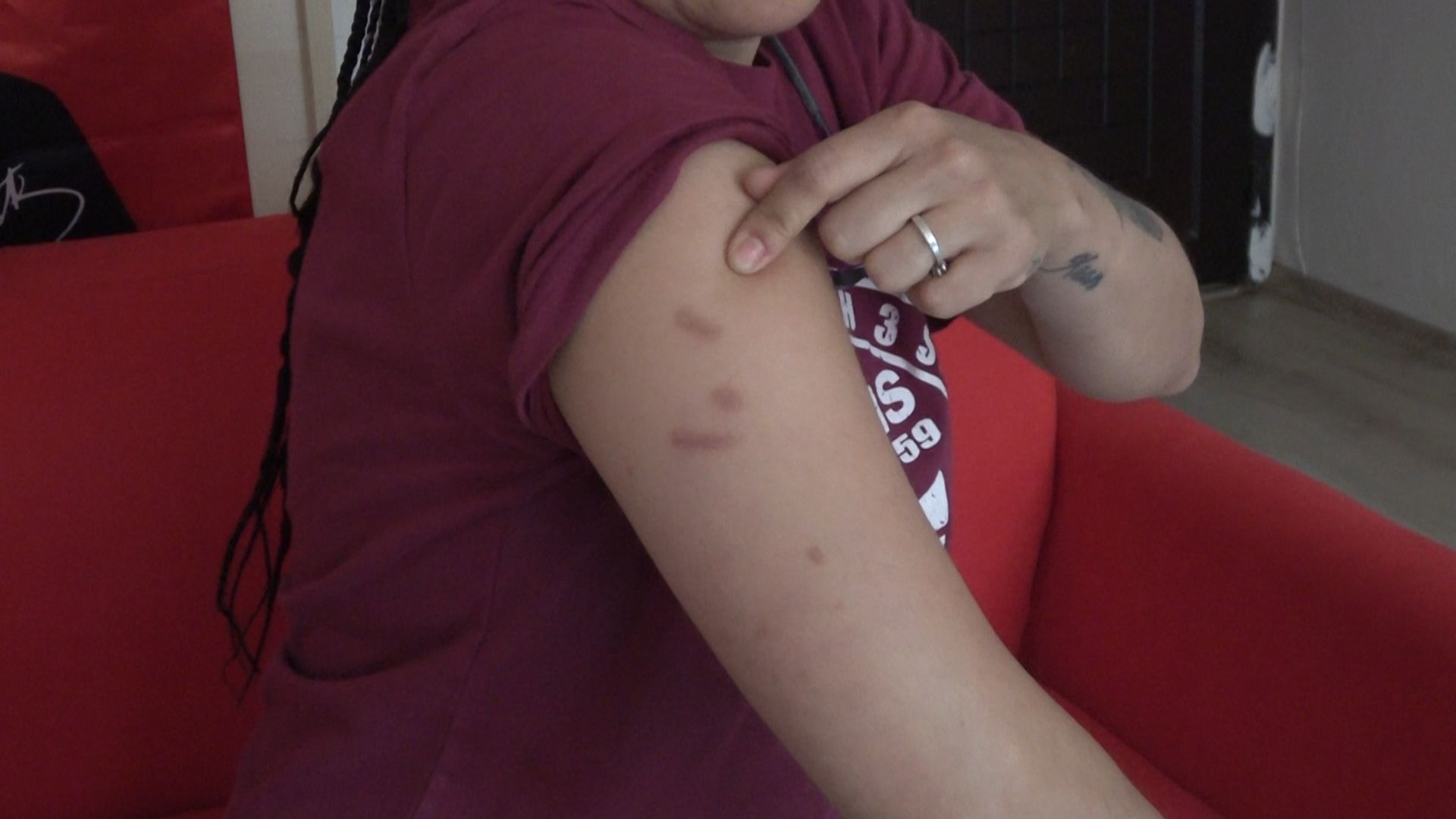 Kadın dart antrenörü turnuvada darp edildi - 1. Resim