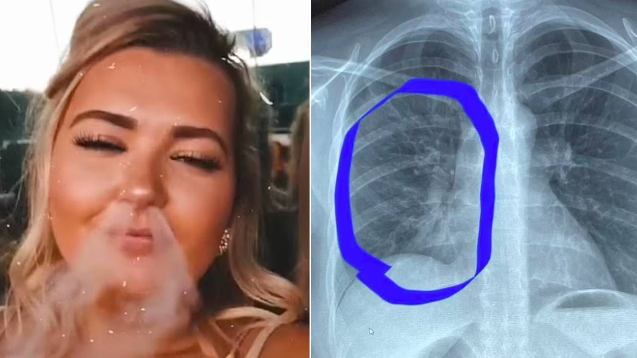Elektronik sigara kullanan kadının ciğerlerinden patlama sesi geldi