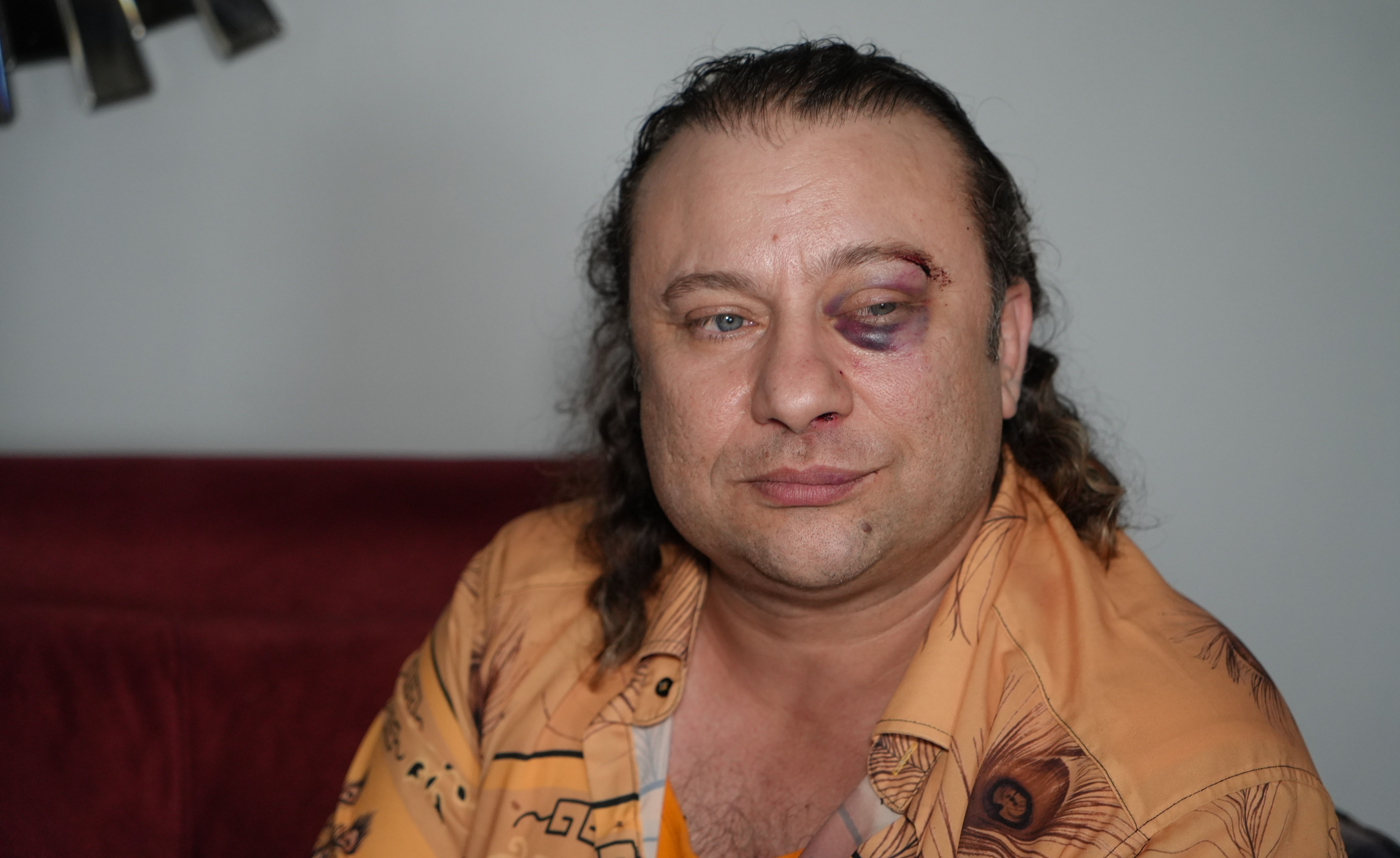 Onur Akay saldırıya uğradı! Kadir Doğulu iddiası gündem oldu - 1. Resim