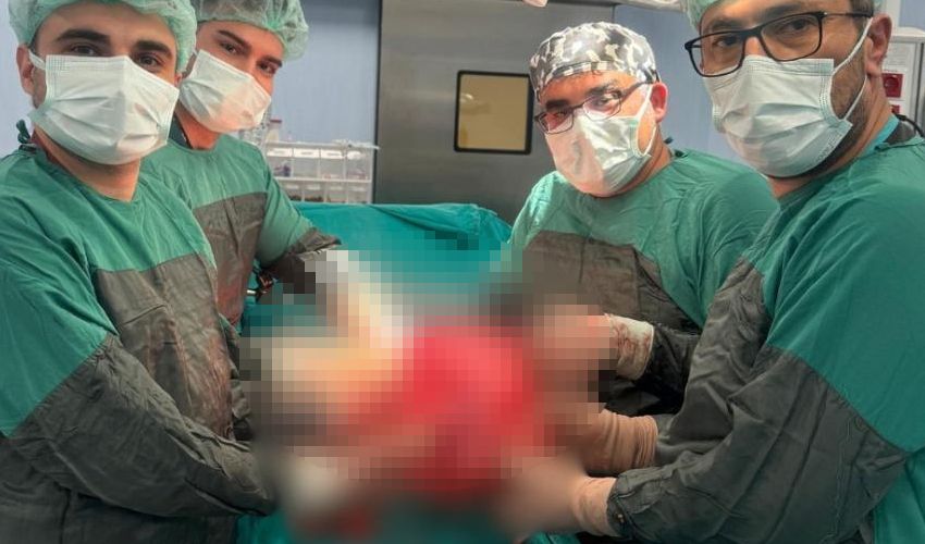 Karın ağrısı ve şişkinlik şikayetiyle gitti, böbreğinden çıkana inanamadı! ‘Duyunca çok şaşırdım’ Karın ağrısı ve şişkinlik şikayetiyle gitti, böbreğinden çıkana inanamadı! ‘Duyunca çok şaşırdım’ - 1. Resim