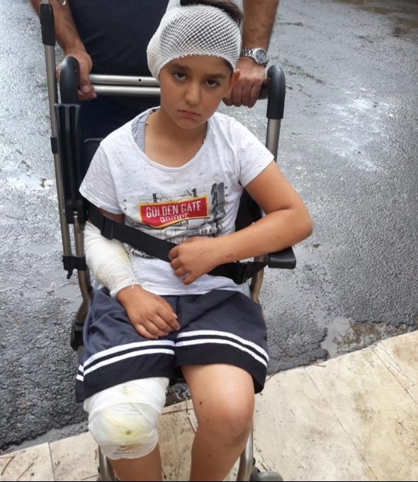 5 sene önce 8 köpeğin saldırısına uğrayan Yasin Alökmen'in acısı dinmiyor - 6. Resim