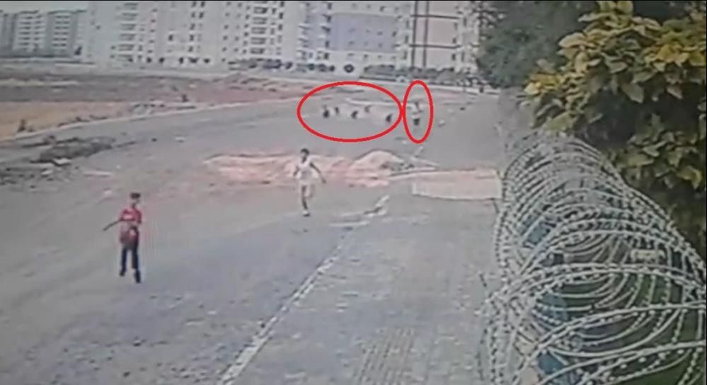 5 sene önce 8 köpeğin saldırısına uğrayan Yasin Alökmen'in acısı dinmiyor - 4. Resim