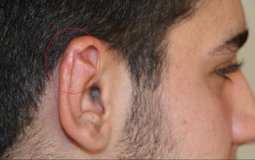 5 sene önce 8 köpeğin saldırısına uğrayan Yasin Alökmen'in acısı dinmiyor - 3. Resim