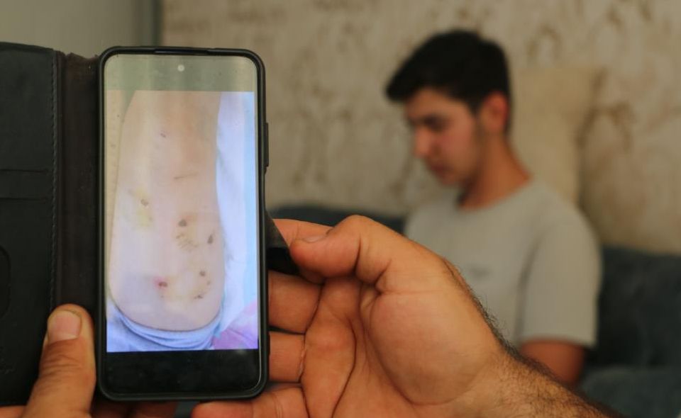 5 sene önce 8 köpeğin saldırısına uğrayan Yasin Alökmen'in acısı dinmiyor - 1. Resim