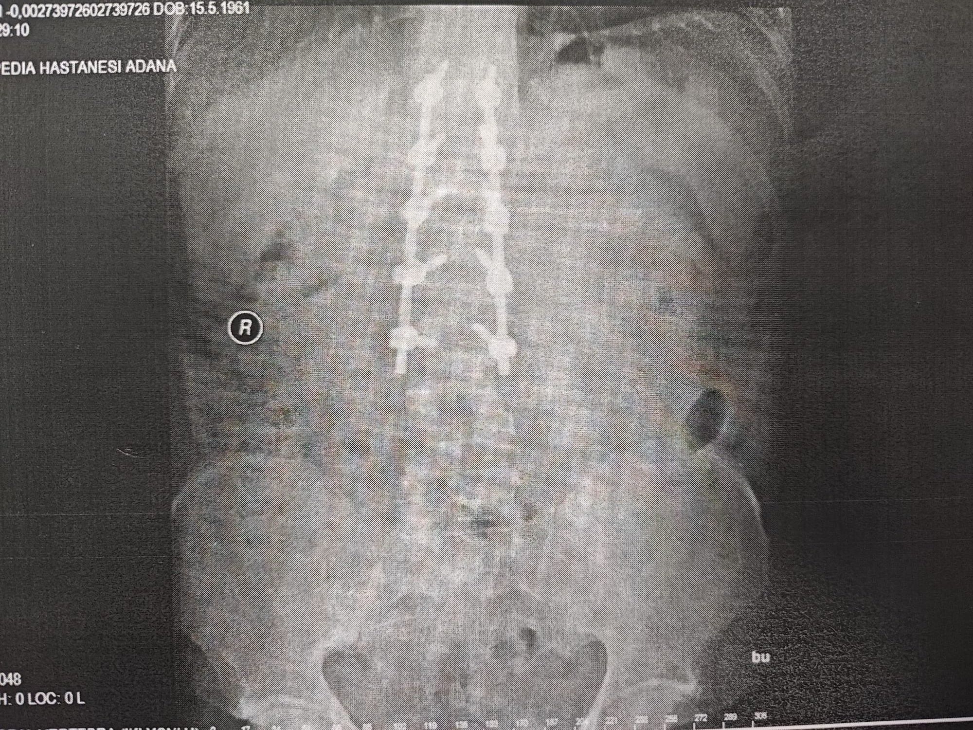 Mercedes hayatını kararttı, hukuk mücadelesi başlattı - 4. Resim
