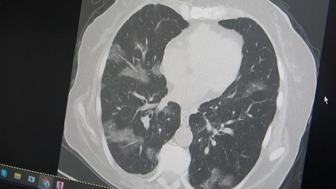 Hastane koridorları 'flört' vakalarıyla doldu taştı! Bu yaza damgasını vuracak Hastane koridorları 'flört' vakalarıyla doldu taştı! Bu yaza damgasını vuracak - 1. Resim