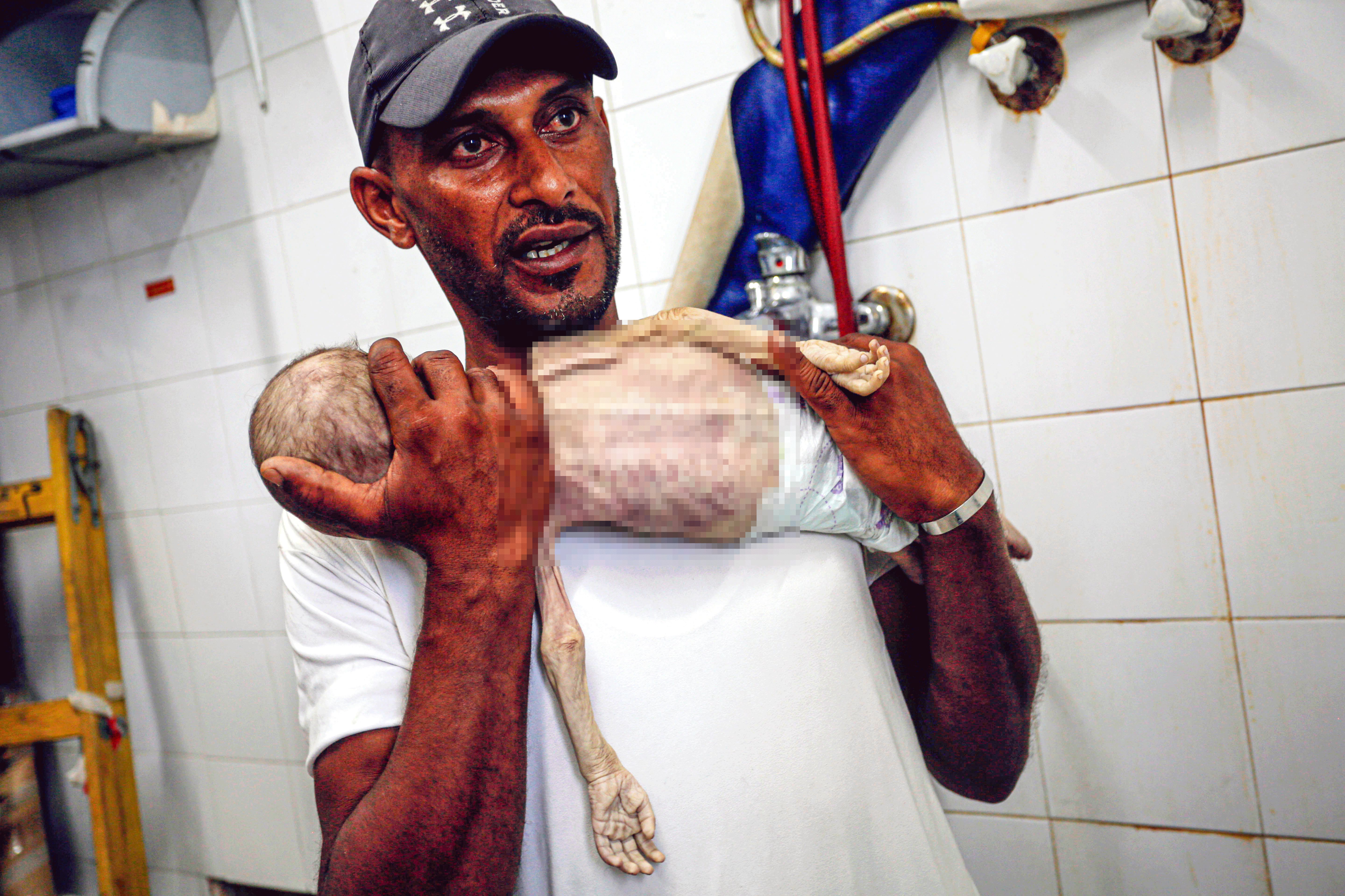 İsrail, Filistinlileri açlığa mahkum etti! 7 aylık bebeğin görüntüsü tüyleri diken diken etti İsrail, Filistinlileri açlığa mahkum etti! 7 aylık bebeğin görüntüsü tüyleri diken diken etti - 1. Resim