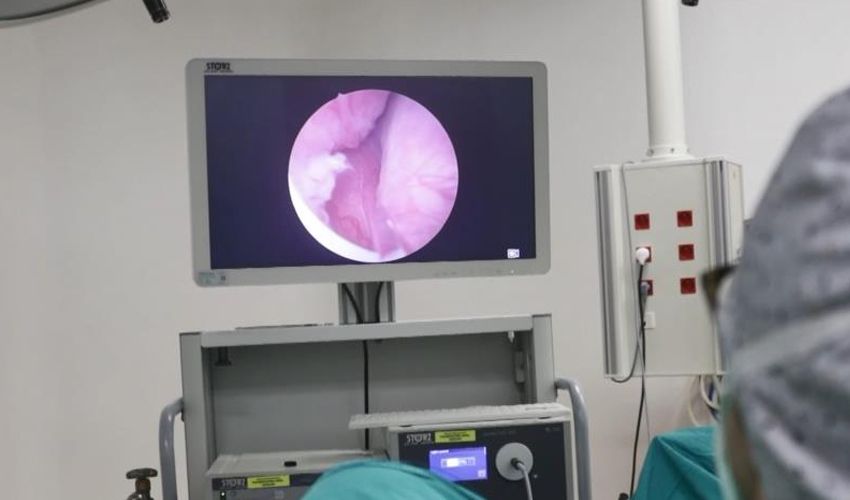 Ameliyattan yıllarca kaçtı, sonunda doktora gitti! 350 gram prostat çıkarıldı - 1. Resim