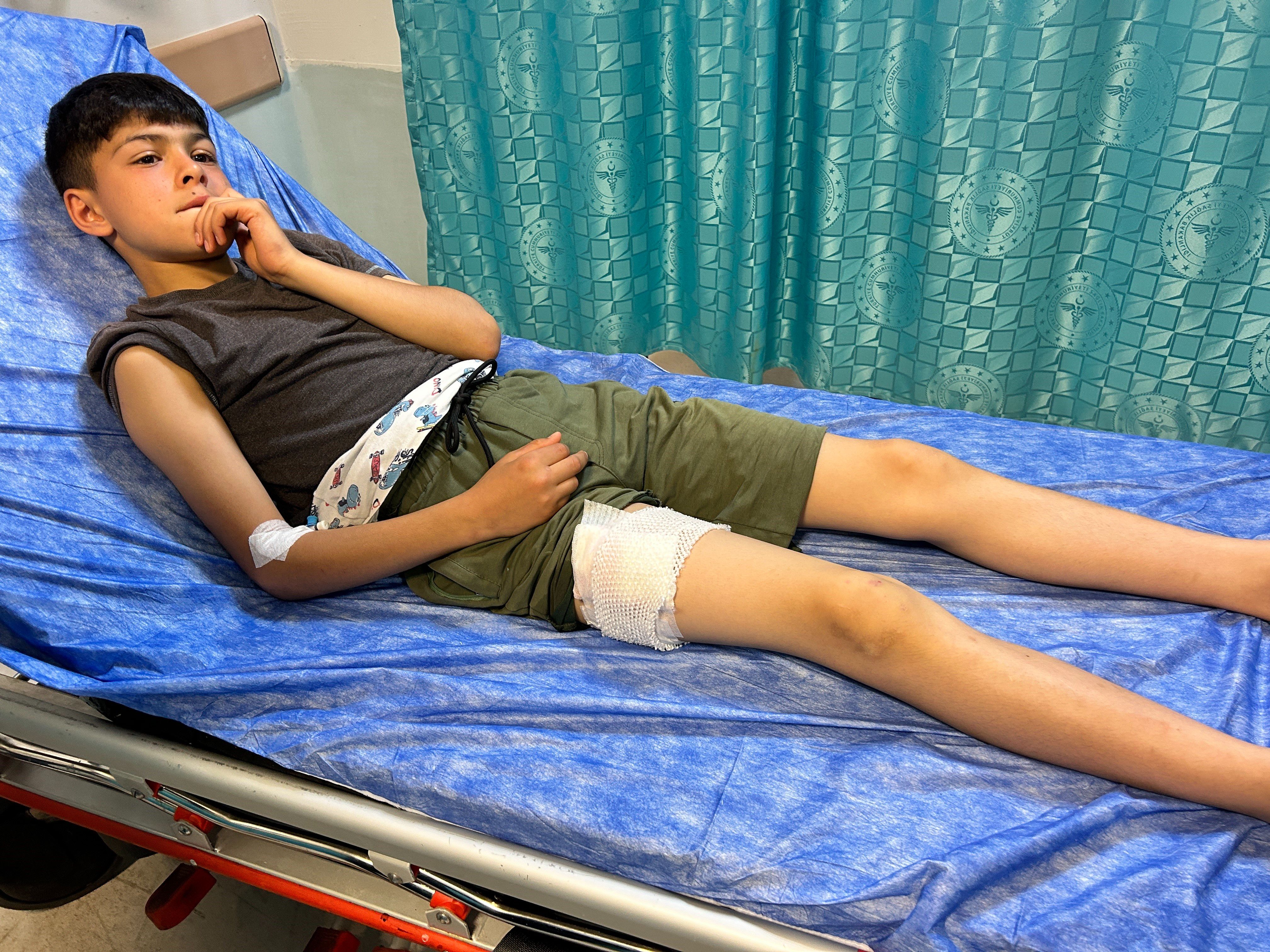 Başıboş köpeklere yem oluyordu! 13 yaşındaki çocuk canını zor kurtardı - 1. Resim