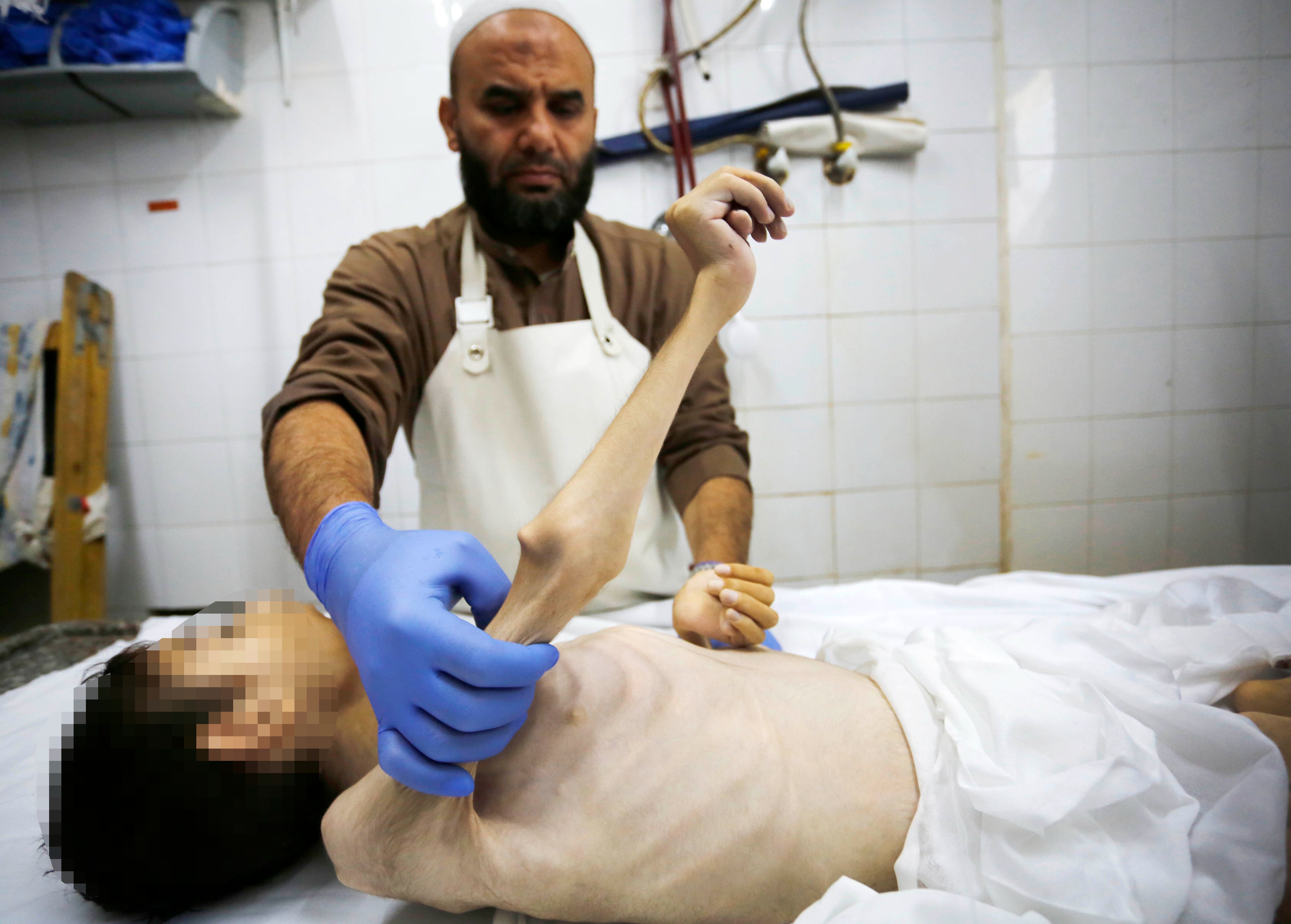 İsrail, bir çocuğu daha açlıktan öldürdü! - 4. Resim