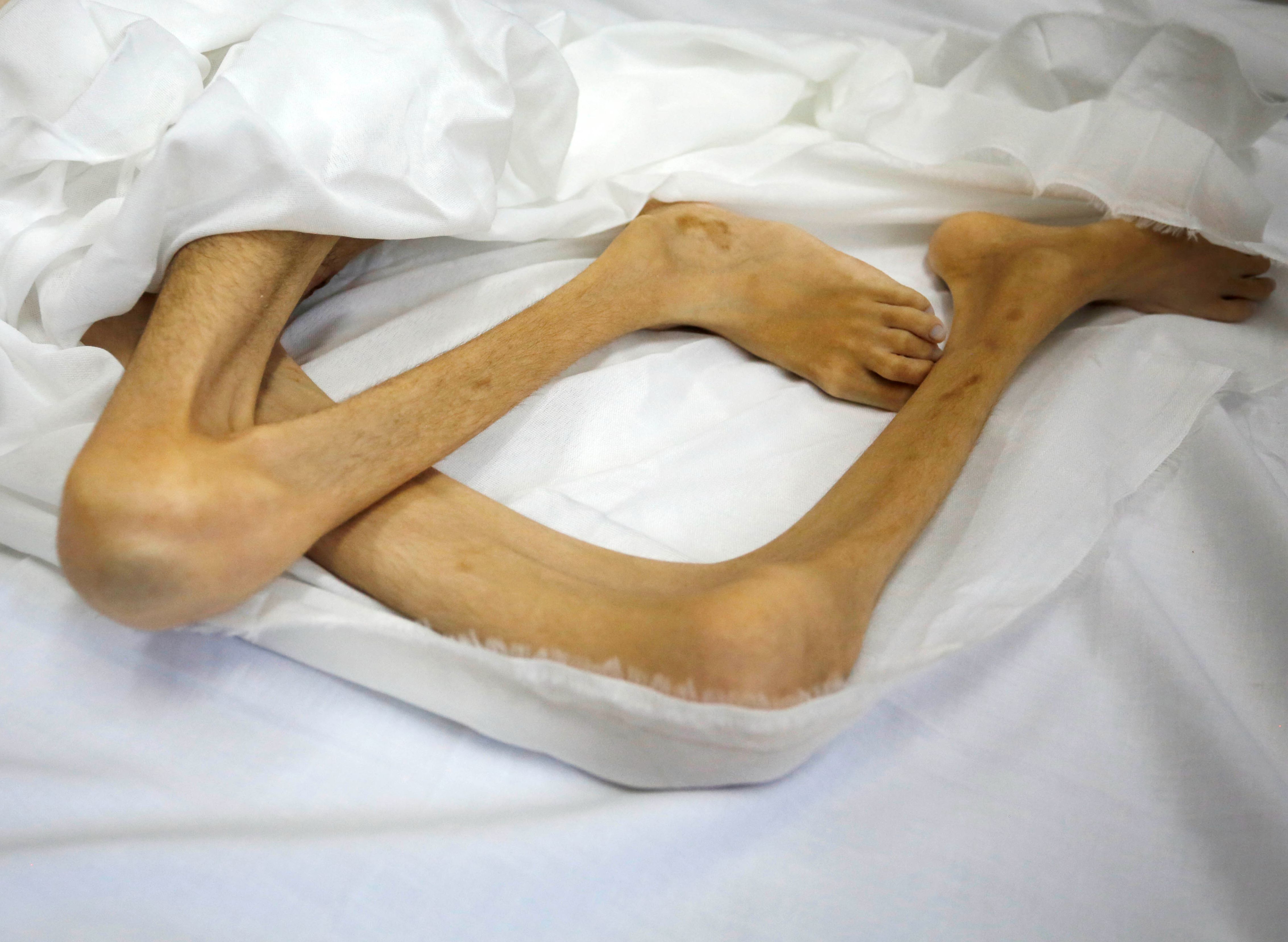 İsrail, bir çocuğu daha açlıktan öldürdü! - 5. Resim