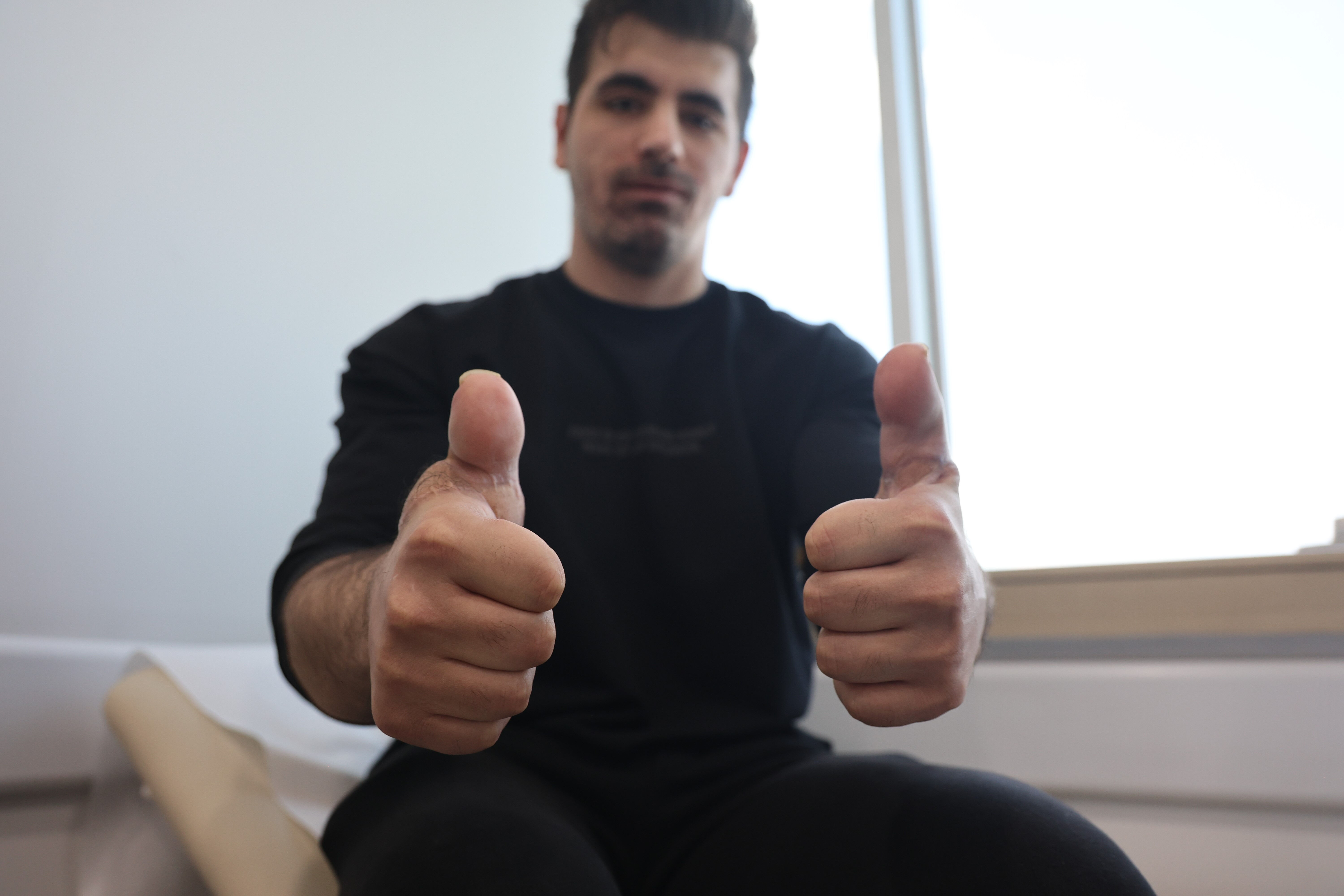 350 tonluk pres parmaklarını koparmıştı: Ayak parmakları eline dikildi 350 tonluk pres parmaklarını koparmıştı: Ayak parmakları eline dikildi - 1. Resim