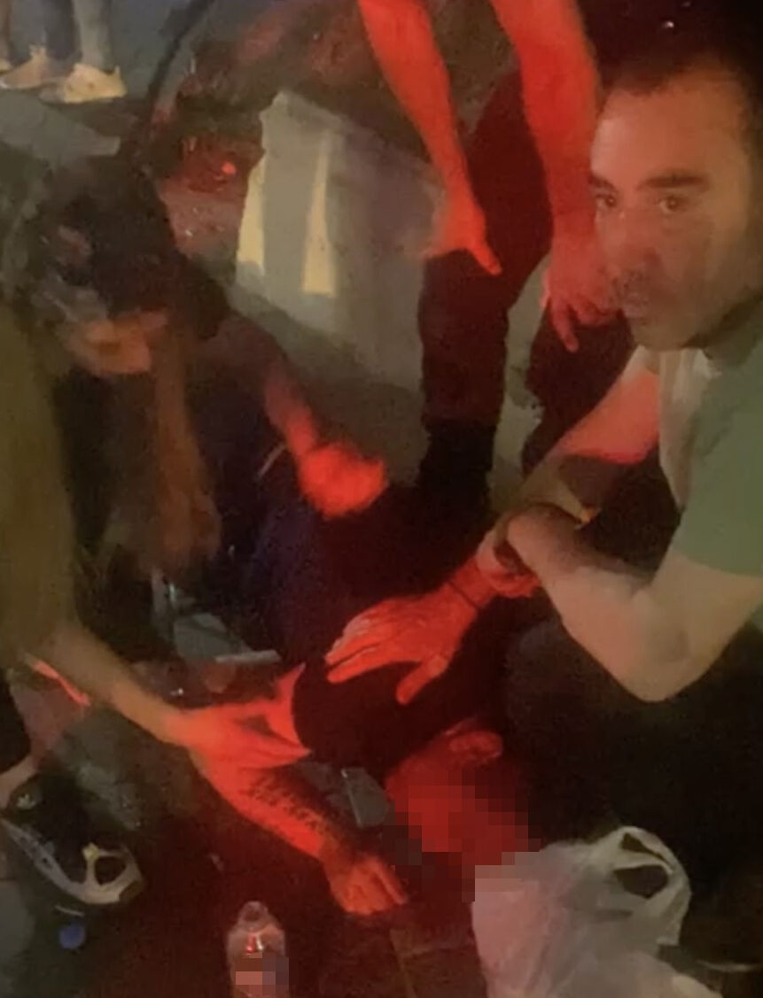 Fare zehri içen şahsa ilk müdahaleyi, yoldan geçen doktor yaptı - 1. Resim