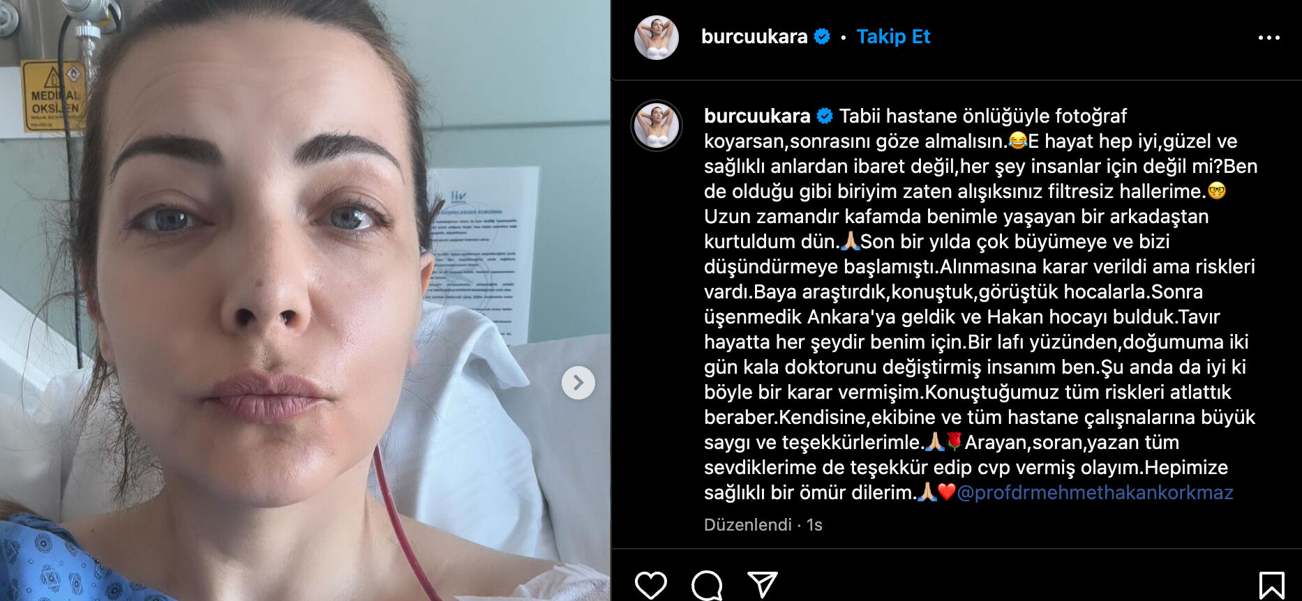 Ameliyat olan Burcu Kara, sağlık durumunun iyi olduğunu sosyal medya hesabından paylaştı - 1. Resim