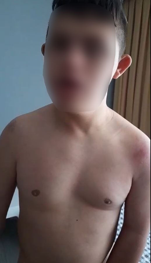 Ankara'da 'down sendromlu öğrenciye darp' iddiası! İşte kan donduran eziyetin görüntüleri... - 3. Resim