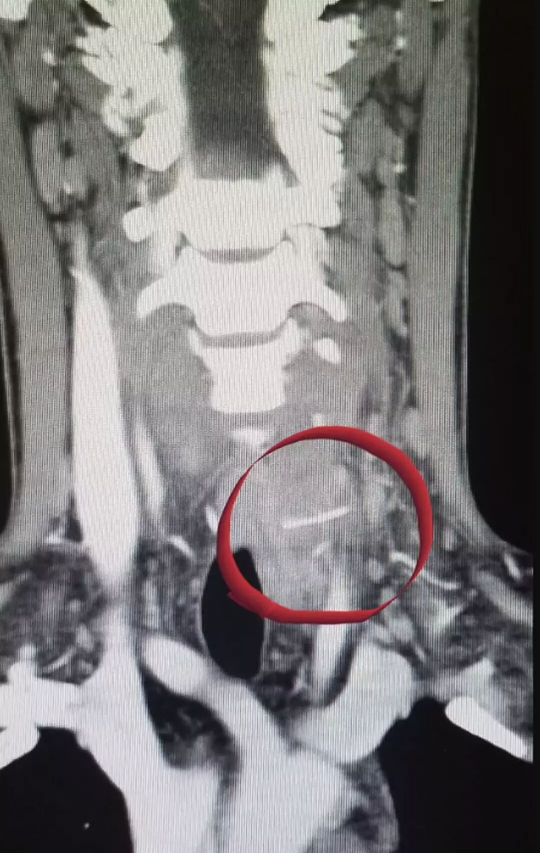 Mangala attığı tavuk hayatını kararttı! Bir haftada eridi, korkunç gerçek sonradan ortaya çıktı - 4. Resim