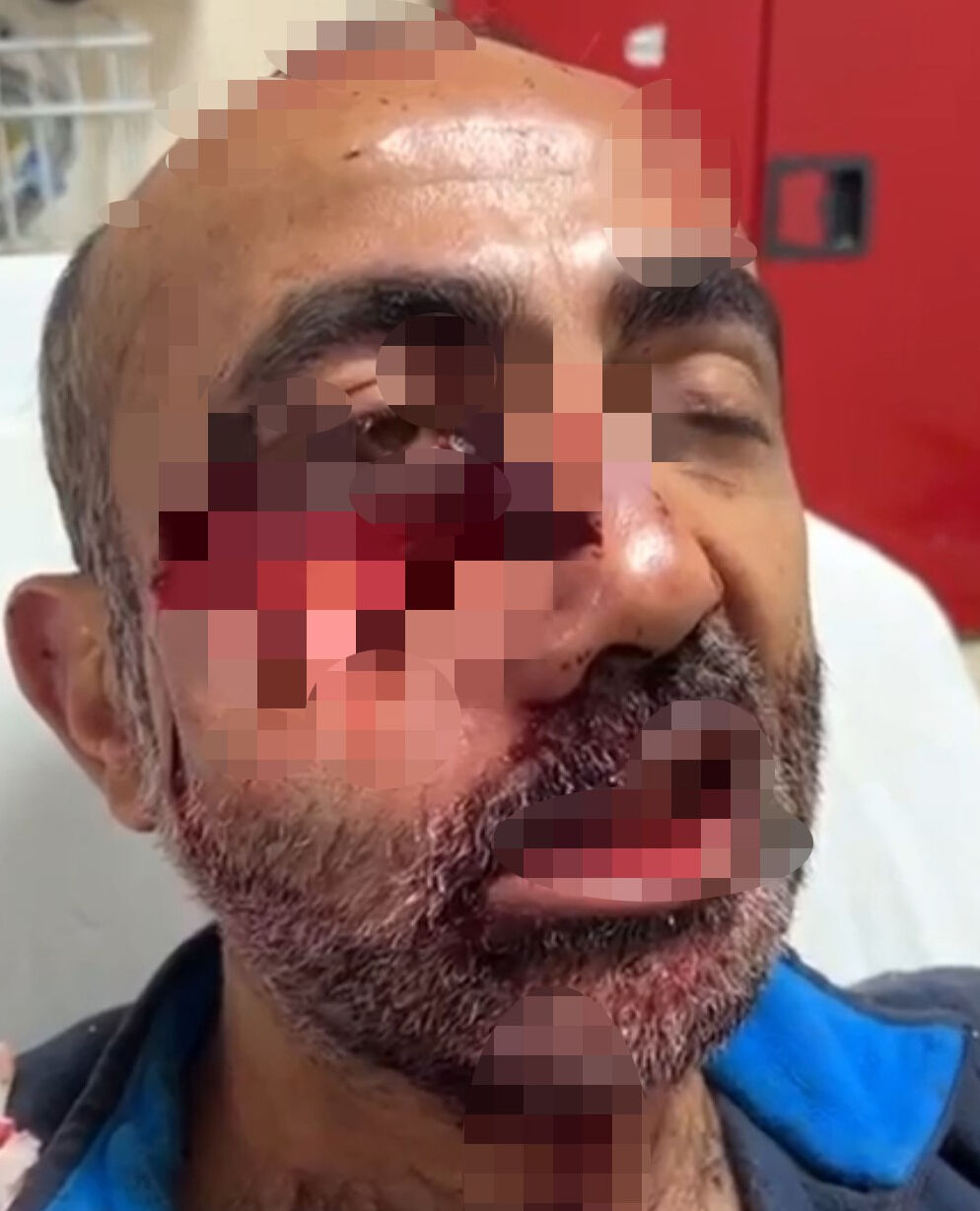 Hakkari'de iki ayının saldırısına uğrayan adamın yüzü parçalandı - 1. Resim