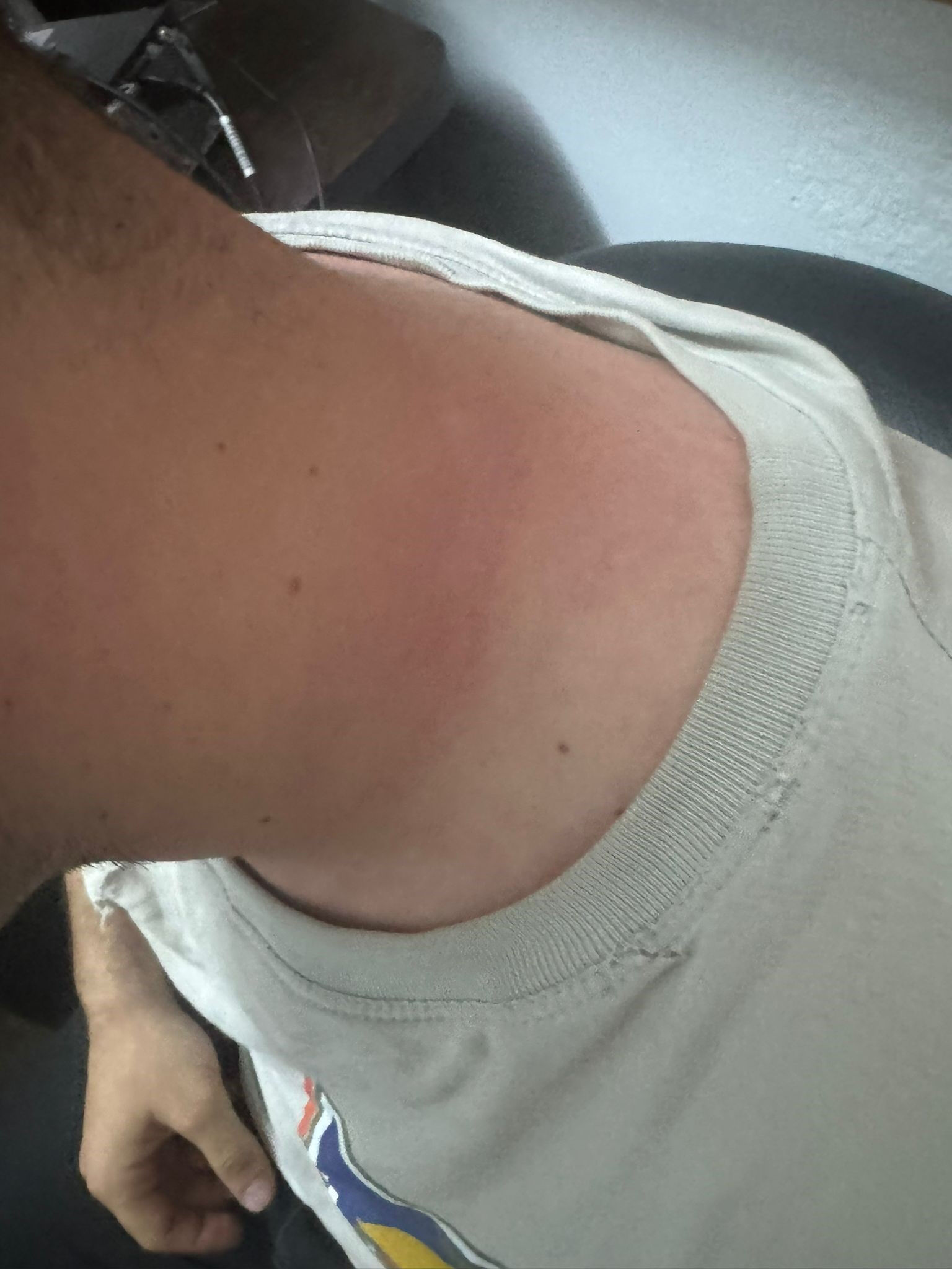 İHA muhabirine çirkin saldırı! Hasta köpeklerin Ankara'ya taşınması soruşturmasında darp edildi İHA muhabirine çirkin saldırı! Hasta köpeklerin Ankara'ya taşınması soruşturmasında darp edildi - 2. Resim