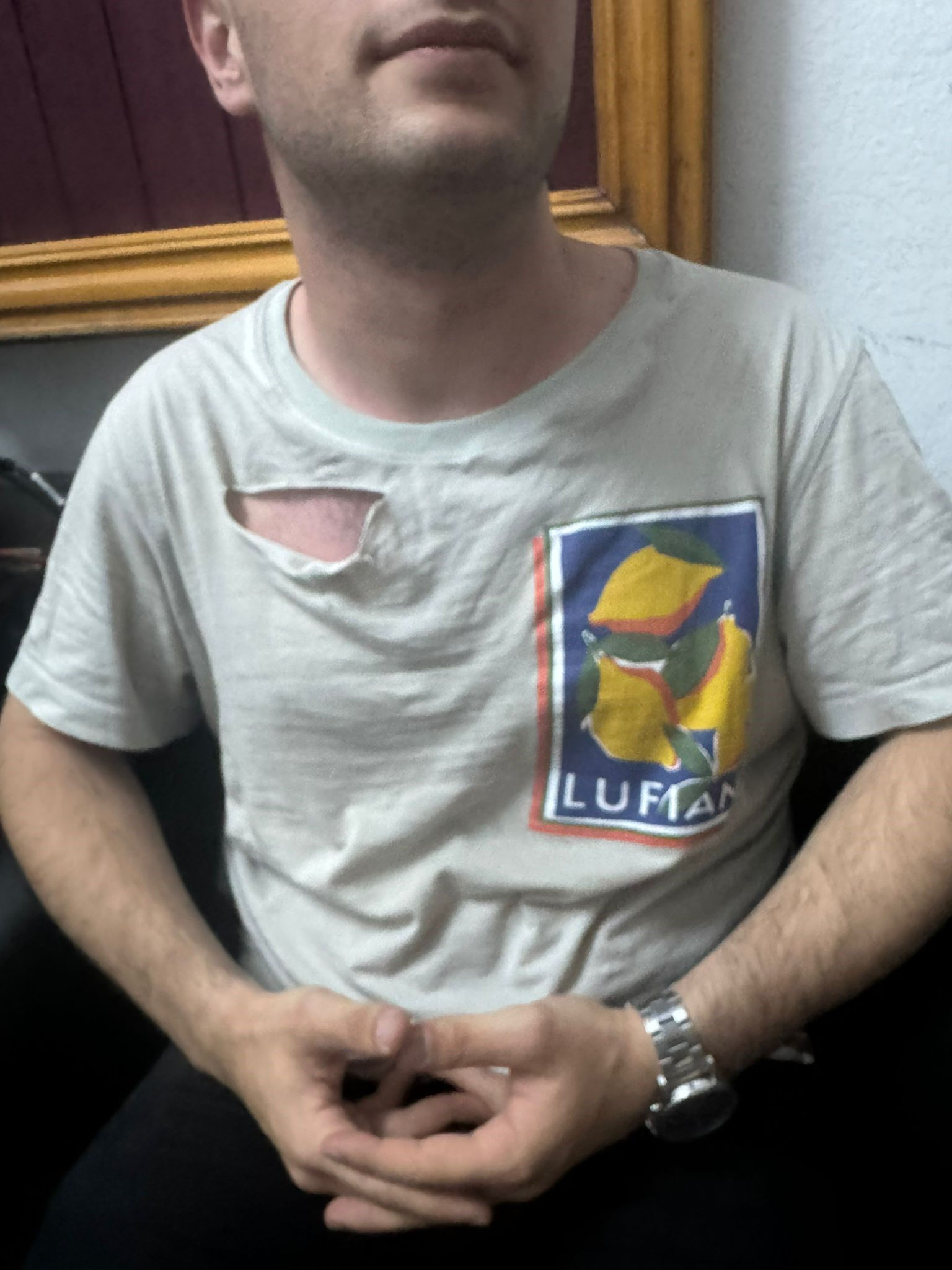 İHA muhabirine çirkin saldırı! Hasta köpeklerin Ankara'ya taşınması soruşturmasında darp edildi İHA muhabirine çirkin saldırı! Hasta köpeklerin Ankara'ya taşınması soruşturmasında darp edildi - 1. Resim