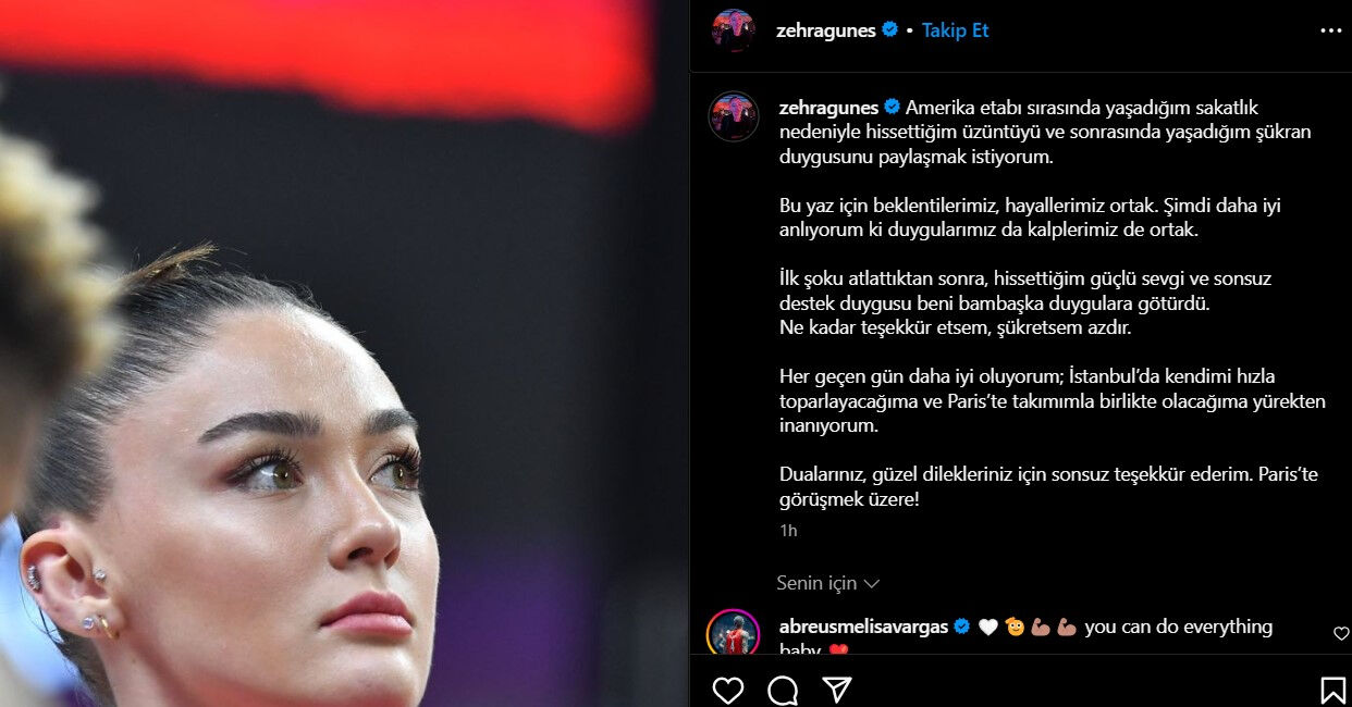 Zehra Güneş, tedavisinin devam etmesi sebebiyle Milletler Ligi Dominik Cumhuriyeti maçının kadrosunda yer almadı Zehra Güneş, tedavisinin devam etmesi sebebiyle Milletler Ligi Dominik Cumhuriyeti maçının kadrosunda yer almadı - 1. Resim