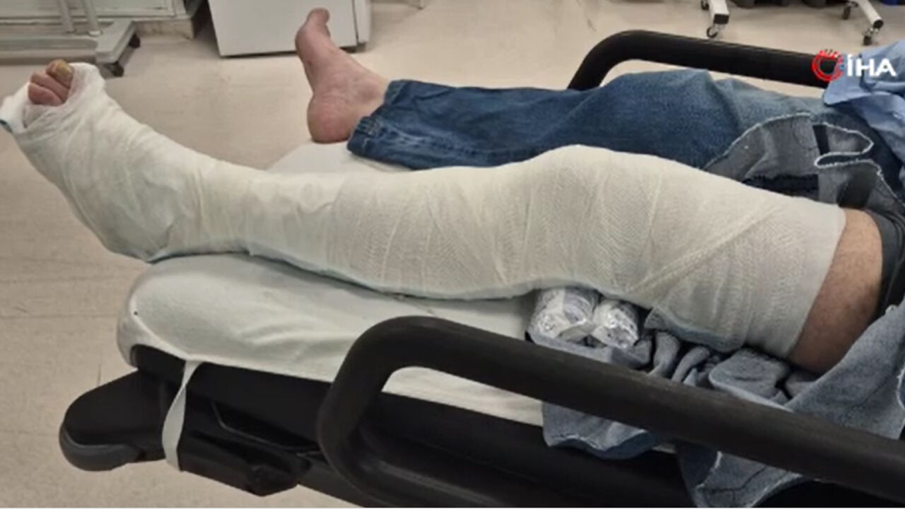 Acemi kasaplar soluğu hastanede aldı! Acil servisler doldu taştı - 1. Resim