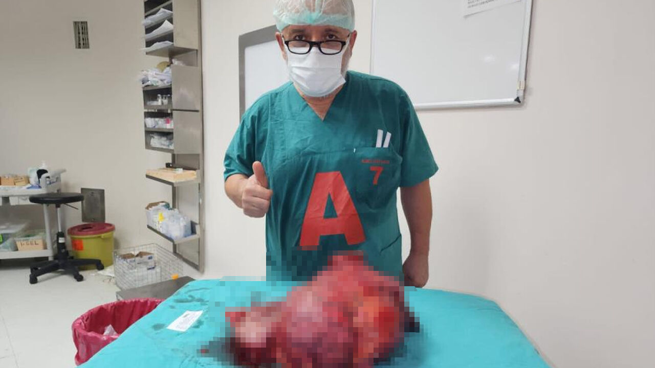 Karın ağrısı şikayetiyle hastaneye gitti, karnından çıkana doktorlar bile inanamadı Karın ağrısı şikayetiyle hastaneye gitti, karnından çıkana doktorlar bile inanamadı - 1. Resim
