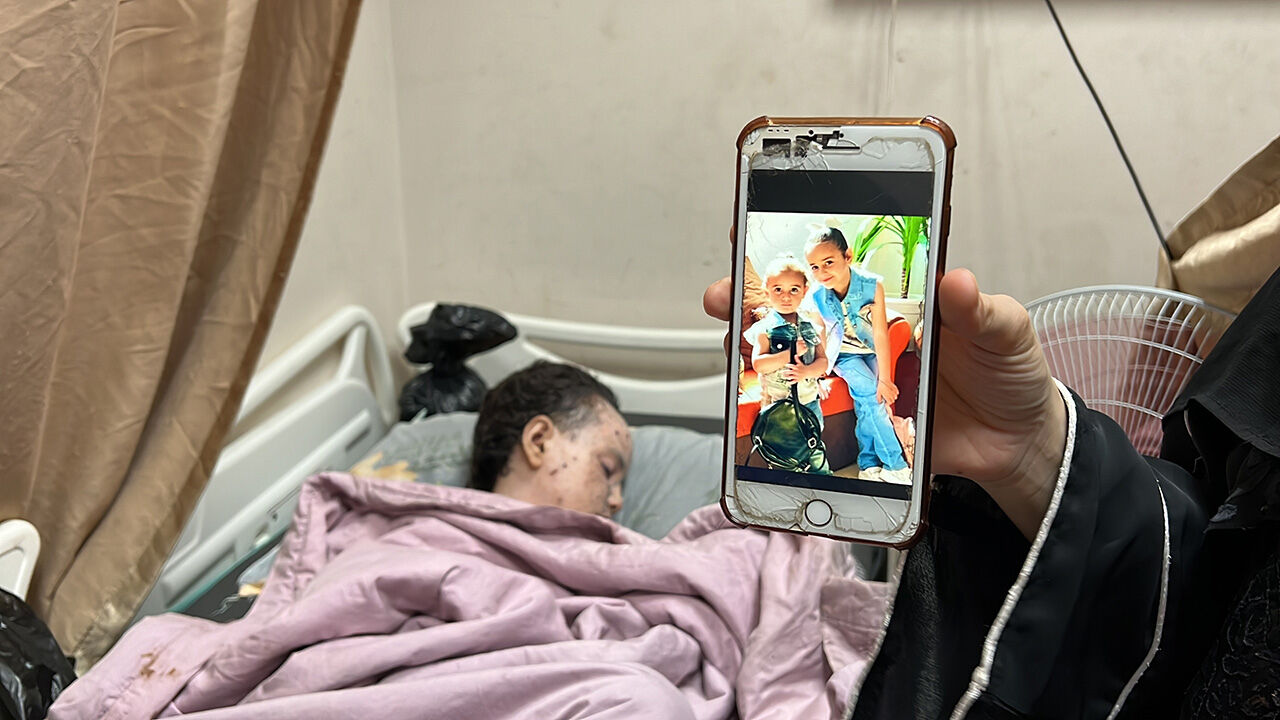 Gazze'de son durum... Yürek yakan kare... 9 yaşındaki Hanan Alaa Akl yaşam mücadelesi veriyor! - 1. Resim