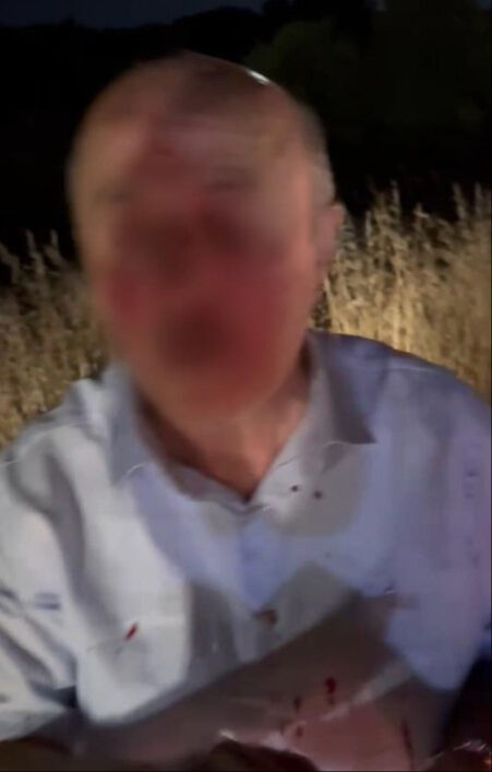 Samsun'da trafikte tartıştığı kişiler tarafından hem darbedildi hem de aracı parçalandı Samsun'da trafikte tartıştığı kişiler tarafından hem darbedildi hem de aracı parçalandı - 3. Resim