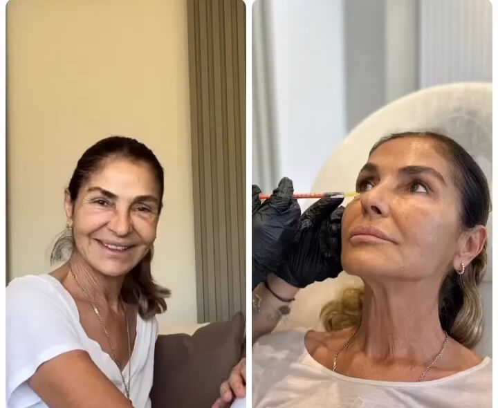 İbrahim Tatlıses'in eski eşi Derya Tuna yüzünü gerdirdi! Son haline yorum yağdı - 2. Resim