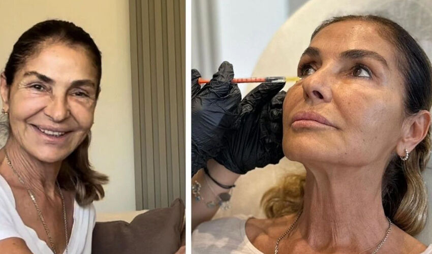 Değişimiyle gündem olan Derya Tuna’dan kafa karıştıran açıklama: Estetikle işim olmaz - 2. Resim