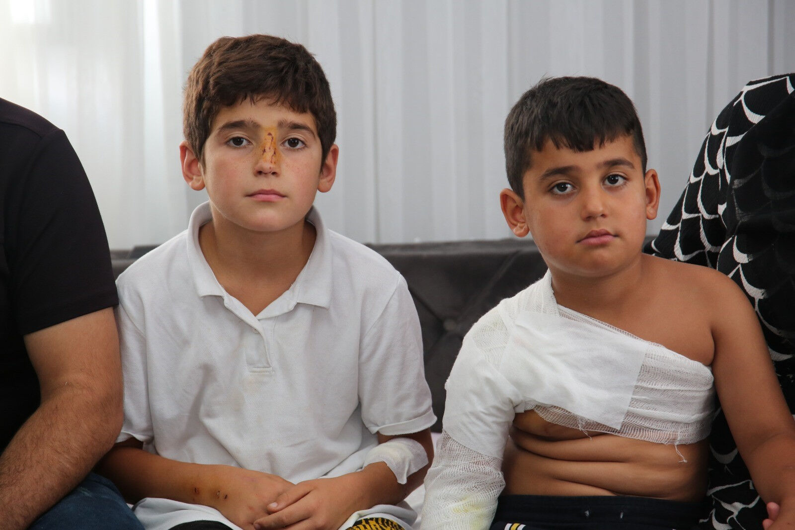 Bahçede oynarken sahipsiz köpeklerin hedefi oldular! İki kardeşi çevredekiler kurtardı - 1. Resim