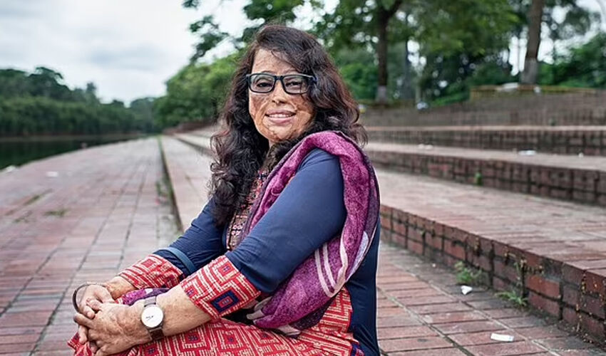 Asitli saldırıya uğrayan kadın 15 yaşındayken kabusu yaşadı! Yıllar sonra yaptığıyla takdir topluyor - 1. Resim