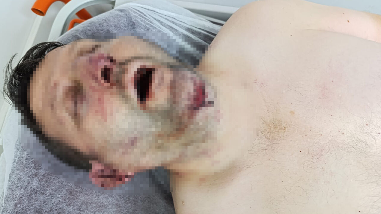 Kula Belediyesi'nde makam odasındaki darbın ifadeleri ortaya çıktı: MHP'den CHP'ye tepki gecikmedi - 1. Resim