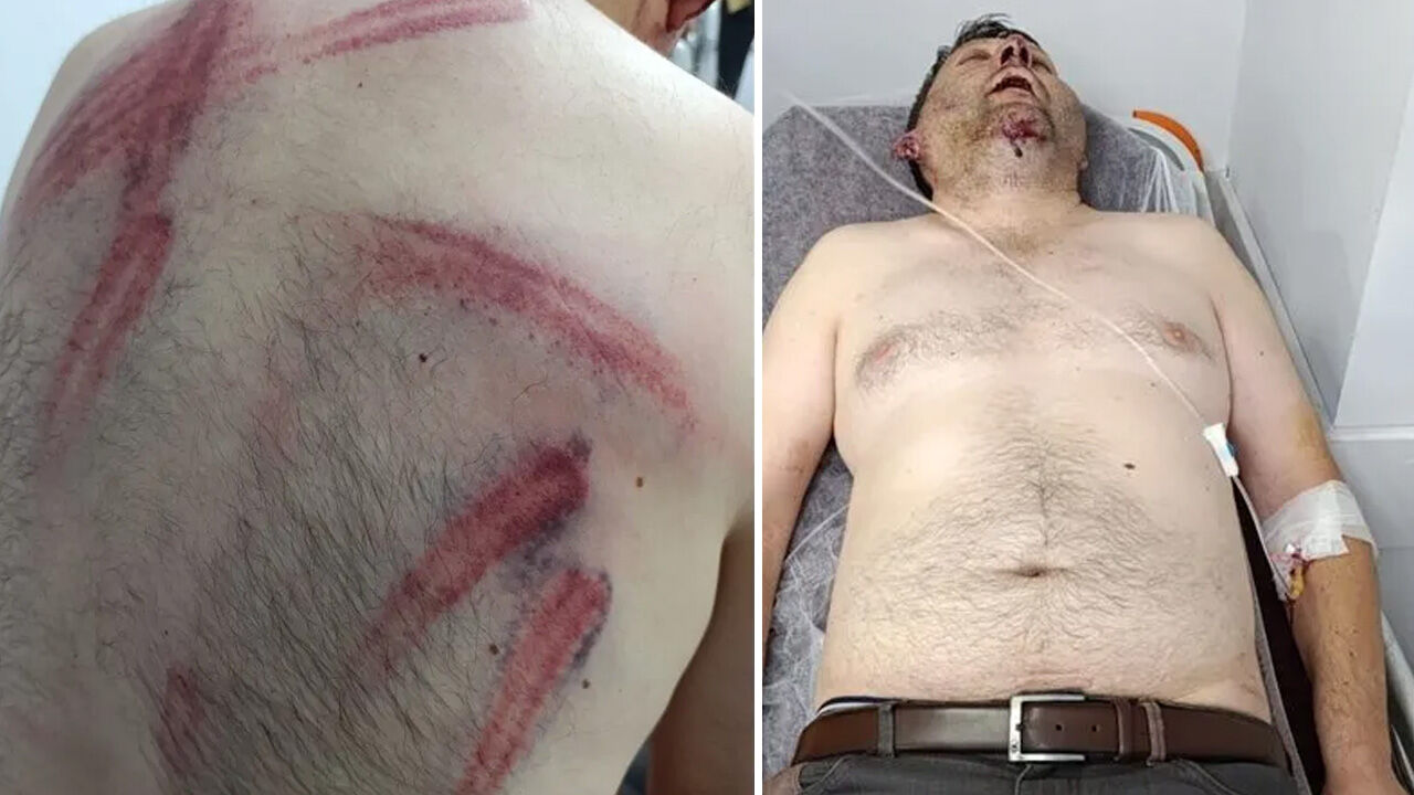 CHP'li Hikmet Dönmez'in darbettirdiği isim o anları anlattı! 