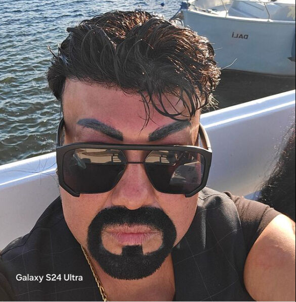 Kobra Murat'ın doktoru peruk takmasını yasaklamıştı! Yeni çözüm buldu - 2. Resim