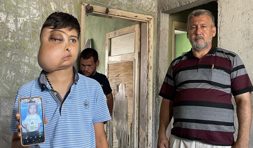 Milyonda bir görülen hastalık: İki farklı yüzü var gibi görünüyor, ailesi doktor doktor gezip çare arıyor Milyonda bir görülen hastalık: İki farklı yüzü var gibi görünüyor, ailesi doktor doktor gezip çare arıyor - 2. Resim