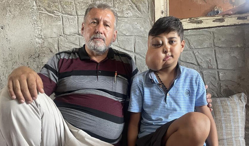 Milyonda bir görülen hastalık: İki farklı yüzü var gibi görünüyor, ailesi doktor doktor gezip çare arıyor Milyonda bir görülen hastalık: İki farklı yüzü var gibi görünüyor, ailesi doktor doktor gezip çare arıyor - 1. Resim