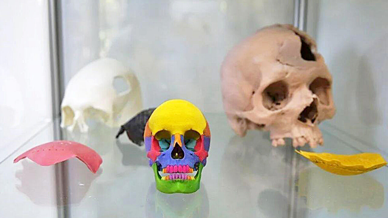 Türkiye'de ilk ve tek! İnsan için 'yedek parça' üretiyorlar Türkiye'de ilk ve tek! İnsan için 'yedek parça' üretiyorlar - 1. Resim