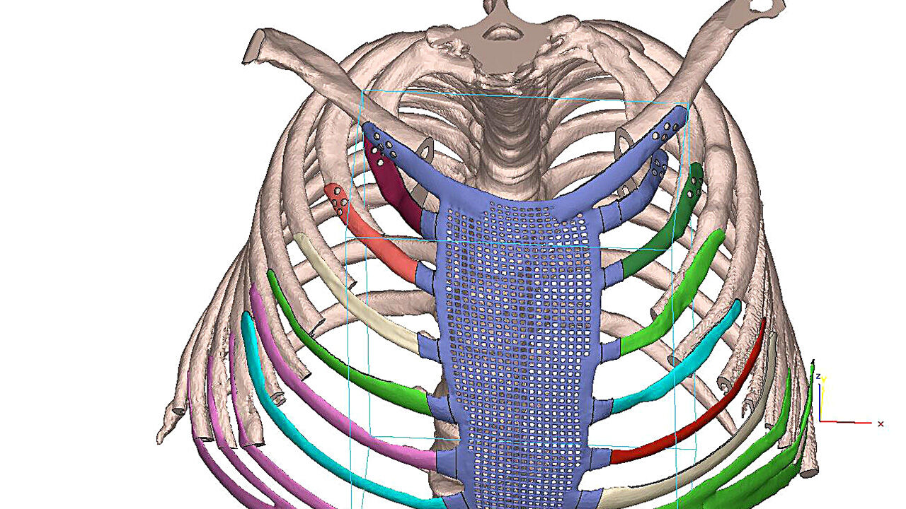 Türkiye'de ilk ve tek! İnsan için 'yedek parça' üretiyorlar Türkiye'de ilk ve tek! İnsan için 'yedek parça' üretiyorlar - 3. Resim