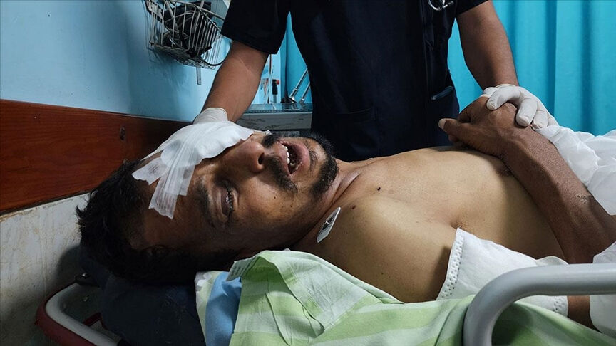 İsrail'in 7 kurşunla yaralayıp işkenceyle kör ettiği Gazzeli Rami Ebu Mustafa öldü - 2. Resim