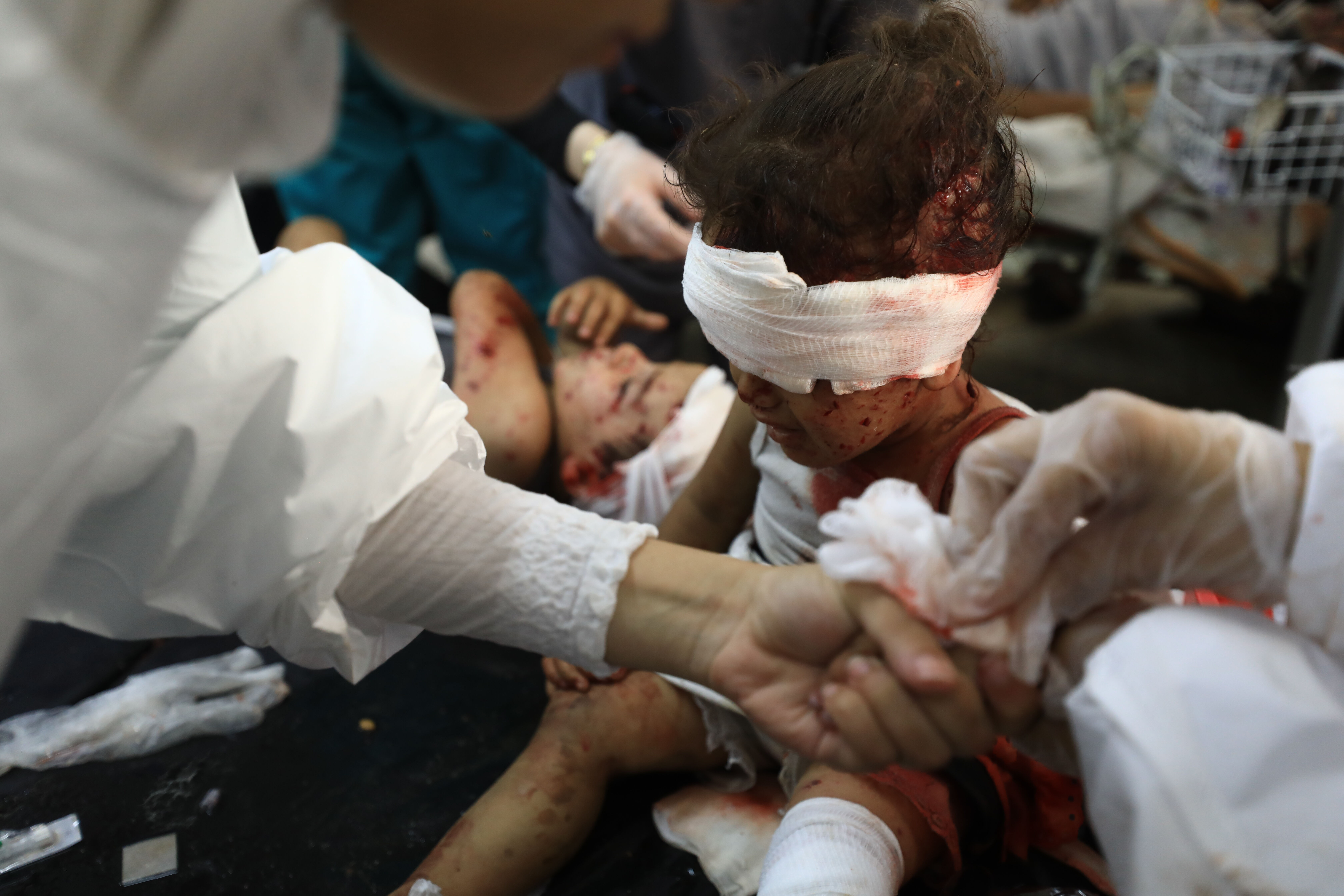 Gazze'den acı görüntüler! İsrail yine çocukları hedef aldı: Çok sayıda ölü ve yaralı var - 1. Resim