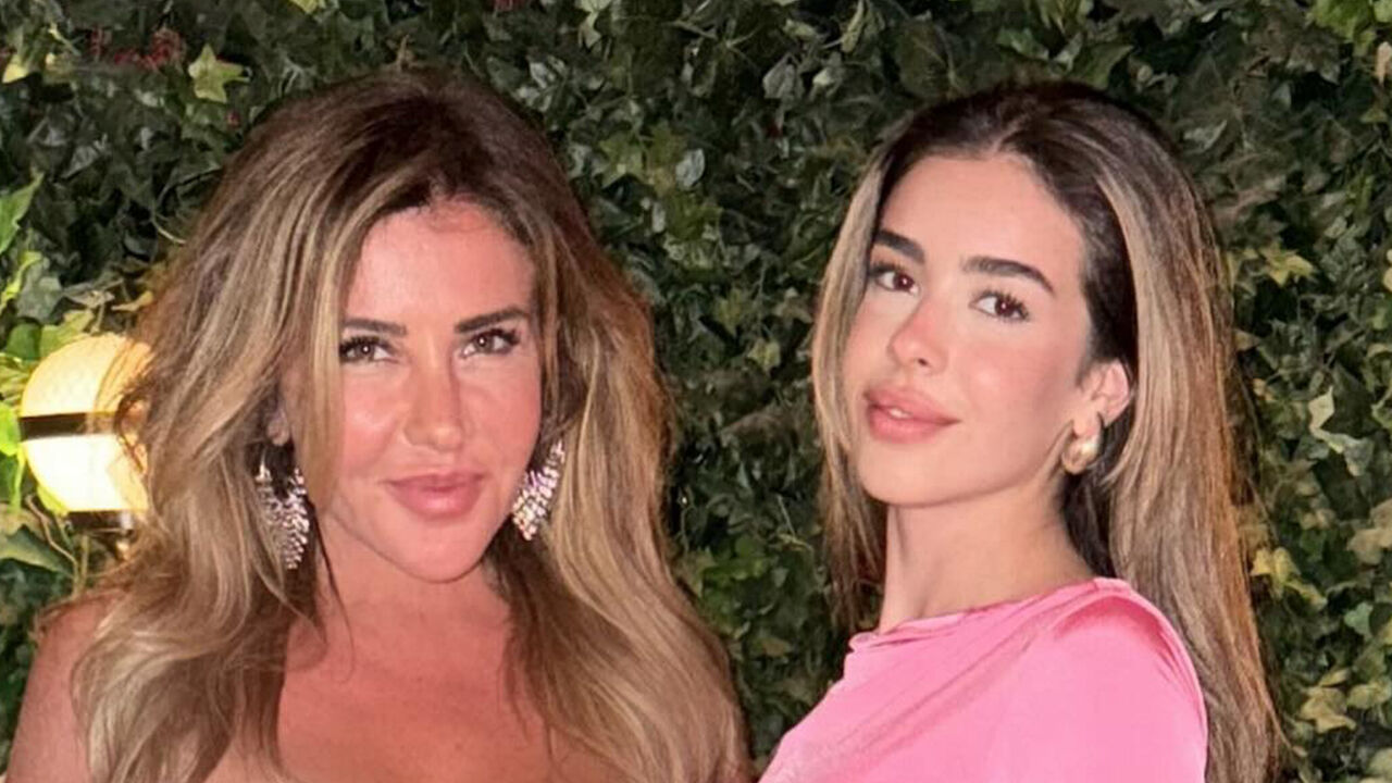 Dudaklarına silikon yaptırdığı iddia edilen Acun Ilıcalı’nın kızına yorum yağdı - 1. Resim