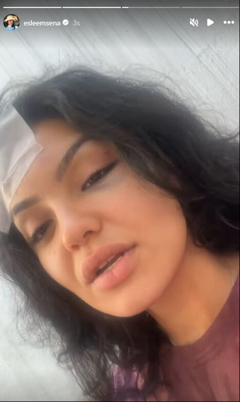 Saldırıya uğrayan eski Kısmetse Olur yarışmacısı Eslem Sena Nur, 2001 yılında doğdu - 2. Resim