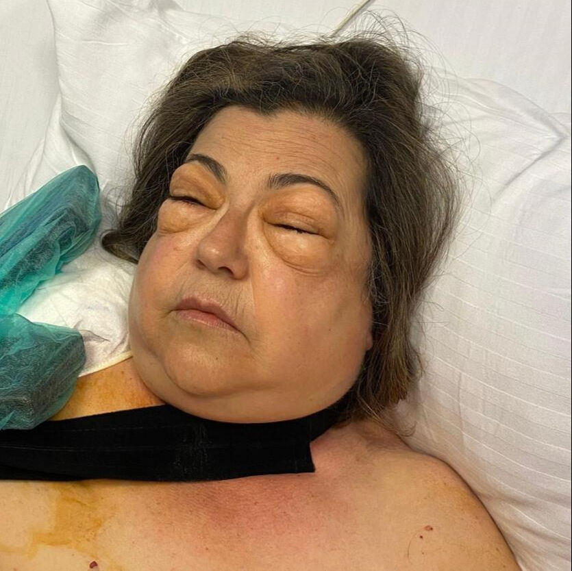 Mide bulantısı ile hastaneye gitti, yüzü gözü tanınmaz hale geldi! Gerçek ortaya çıktı - 3. Resim