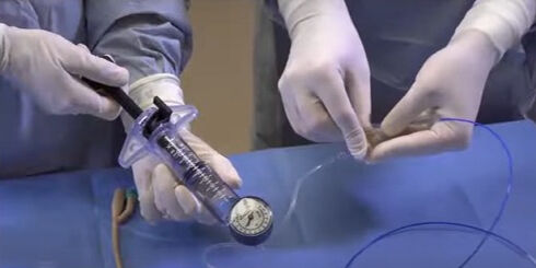 Her 100 erkekten birinin problemine 7 dakikada tedavi! Diyalize götüren hastalığa ameliyatsız çözüm - 1. Resim