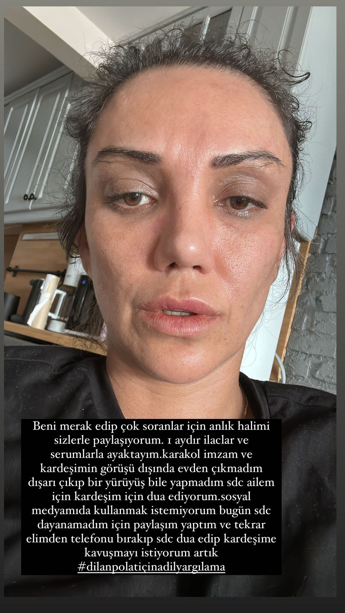 Sıla Doğu tahliye olduktan sonra ilk kez fotoğraf paylaştı! Bitkin hali dikkat çekti Sıla Doğu tahliye olduktan sonra ilk kez fotoğraf paylaştı! Bitkin hali dikkat çekti - 1. Resim